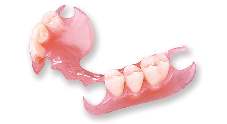 flexible-partial-dentures-front-teeth